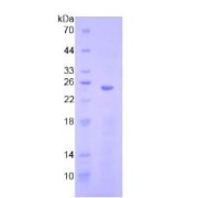 SDS-PAGE analysis of Human HMG1 Protein.