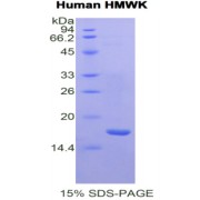 SDS-PAGE analysis of recombinant Human KNG1/HMWK Protein.