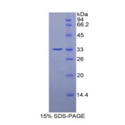 SDS-PAGE analysis of recombinant Rat HDC Protein. <p></p> This protein is the immunogen for the following antibodies: <a href="https://www.abbexa.com/index.php?route=product/search&search=abx102258" target="_blank">abx102258</a>