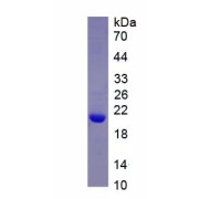 SDS-PAGE analysis of recombinant Human Histone Deacetylase 6 (HDAC6) Protein.