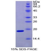 SDS-PAGE analysis of Chicken HIF1a Protein.