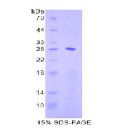 SDS-PAGE analysis of Human Igb Protein.