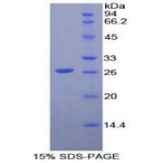 SDS-PAGE analysis of Mouse Igb Protein.