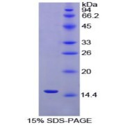 SDS-PAGE analysis of Chicken Inhibin beta A Protein.