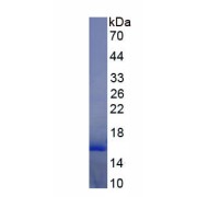 SDS-PAGE analysis of recombinant Rat Inhibin Beta B (INHbB) Protein.