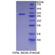 SDS-PAGE analysis of Mouse IKBIP Protein.