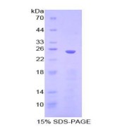 SDS-PAGE analysis of Human IKBIP Protein.