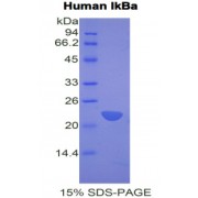 SDS-PAGE analysis of Human IkBa Protein.