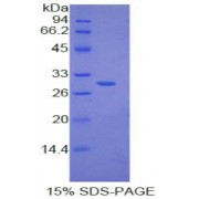 SDS-PAGE analysis of Human IkBd Protein.