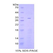 SDS-PAGE analysis of Mouse IkBz Protein.