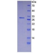 SDS-PAGE analysis of recombinant Human Integrin alpha D Protein.