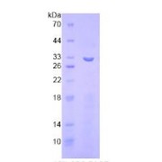 SDS-PAGE analysis of recombinant Human ITFG1 Protein.