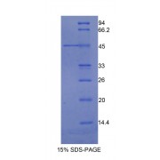 SDS-PAGE analysis of Human Integrin alpha M (ITGAM) Protein.