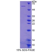 SDS-PAGE analysis of recombinant Human Integrin beta 1 Protein.