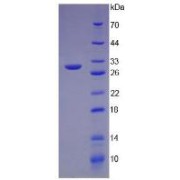 SDS-PAGE analysis of recombinant Human ITLN1 Protein.