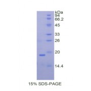 SDS-PAGE analysis of Mouse Intercellular Adhesion Molecule 1 Protein.