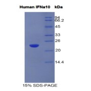 SDS-PAGE analysis of Human Interferon alpha 10 Protein.