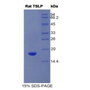 SDS-PAGE analysis of Human IFNa/bR1 Protein.