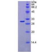 SDS-PAGE analysis of Mouse IFNa/bR1 Protein.