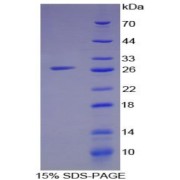 SDS-PAGE analysis of Human IFI16 Protein.