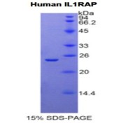 SDS-PAGE analysis of Human IL1RAP Protein.