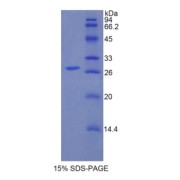 SDS-PAGE analysis of Human IRAK1 Protein.