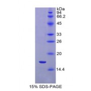 SDS-PAGE analysis of Rat IL1R1 Protein.