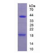 SDS-PAGE analysis of Mouse IL1R1 Protein.