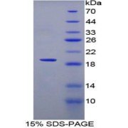 SDS-PAGE analysis of Mouse IL12Rb2 Protein.