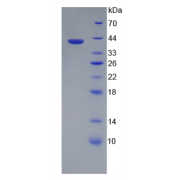 SDS-PAGE analysis of recombinant Human IL12Rb2 Protein.