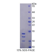 SDS-PAGE analysis of Mouse Interleukin 15 Protein.