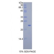 SDS-PAGE analysis of Rat IL17RB Protein.