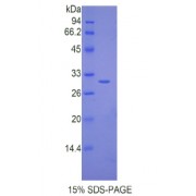 SDS-PAGE analysis of Mouse IL17RC Protein.