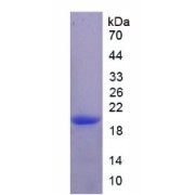 SDS-PAGE analysis of Rat IL17RE Protein.