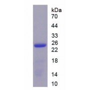 SDS-PAGE analysis of recombinant Human Interleukin 17C (IL17C) Protein.