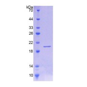 SDS-PAGE analysis of Mouse IL18BP Protein.