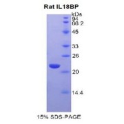 SDS-PAGE analysis of recombinant Rat IL18BP Protein.