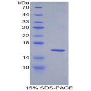 SDS-PAGE analysis of recombinant Mouse IL18R1 Protein.