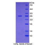 SDS-PAGE analysis of Human IL2Ra Protein.