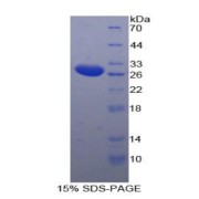 SDS-PAGE analysis of Rat IL2Rb Protein.