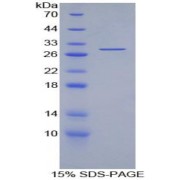 SDS-PAGE analysis of recombinant Mouse IL2Rg Protein.