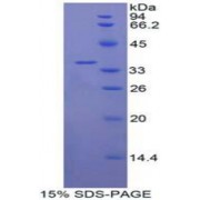 SDS-PAGE analysis of Human IL22R Protein.
