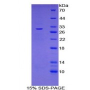 SDS-PAGE analysis of Mouse IL27Ra Protein.