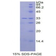 SDS-PAGE analysis of recombinant Human IL31RA Protein.