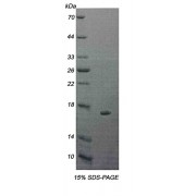 SDS-PAGE analysis of recombinant Human IL5Ra Protein.