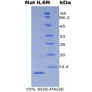 SDS-PAGE analysis of Rat Interleukin 6 Receptor Protein.