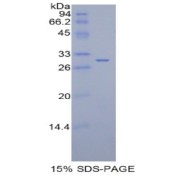 SDS-PAGE analysis of Rat IDH1 Protein.