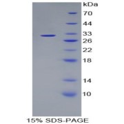 SDS-PAGE analysis of Rat Kallikrein 1 Protein.