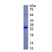 SDS-PAGE analysis of recombinant Rat Keratin 10 (KRT10) Protein.