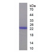 SDS-PAGE analysis of recombinant Human Keratin 17 (KRT17) Protein.